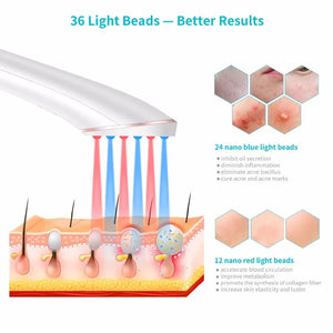 Rechargeable Light Acne Treatment Electronic Worldwide