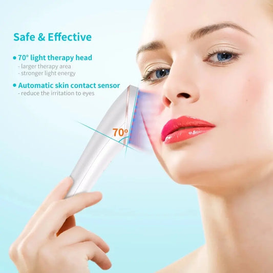 Rechargeable Light Acne Treatment Electronic Worldwide